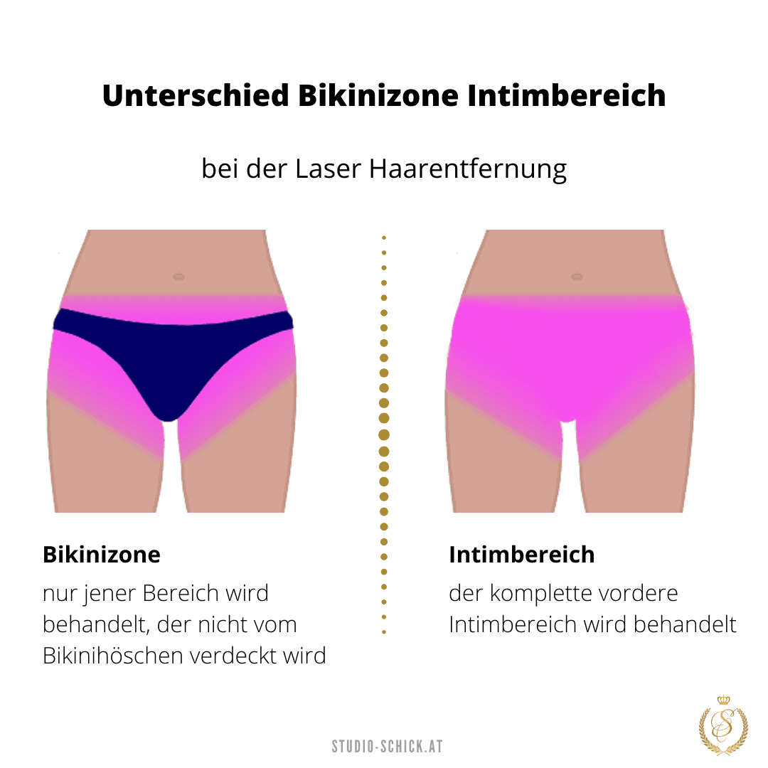 Infografik Was ist die Bikinizone